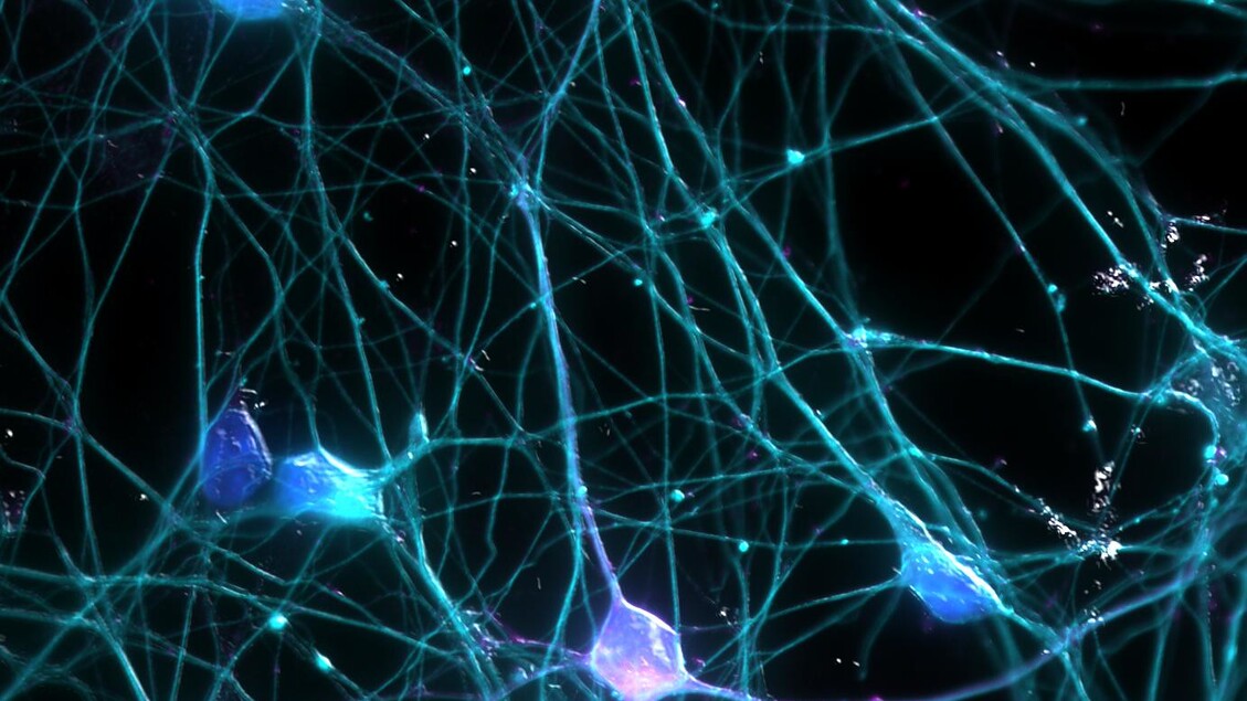 Parkinson: nanocorpi ripristinano un enzima fondamentale per i neuroni