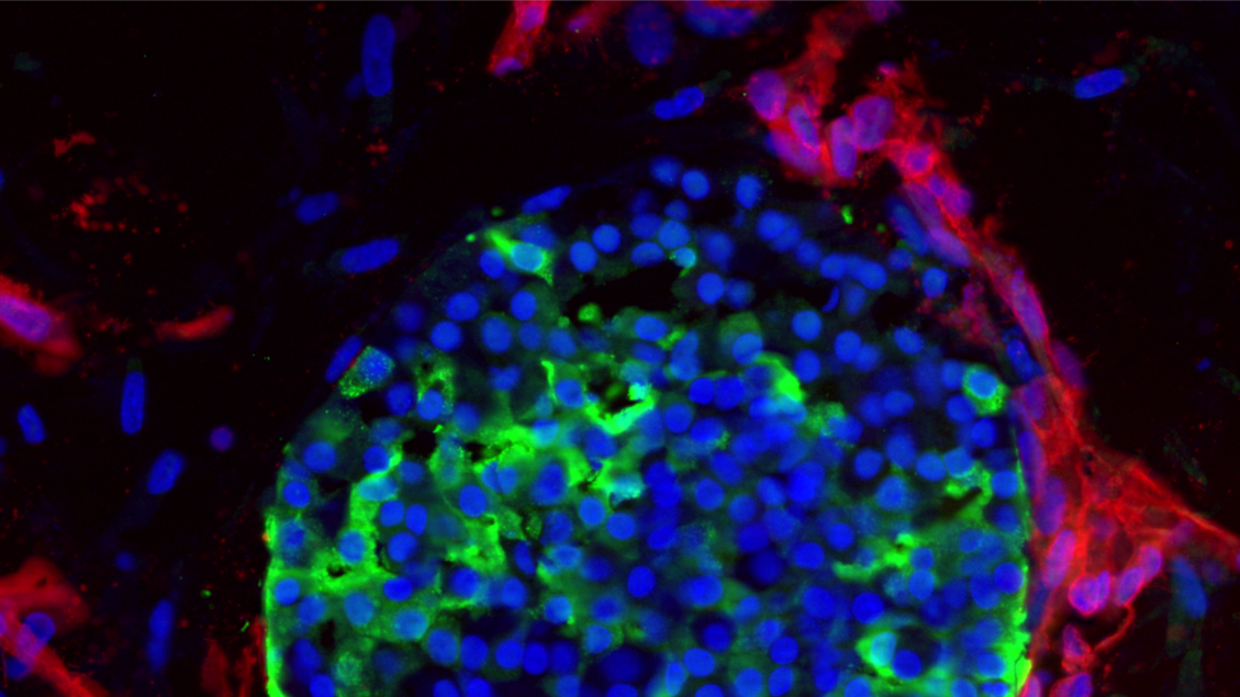 Sviluppati i primi organoidi dotati di un sistema vascolare funzionale