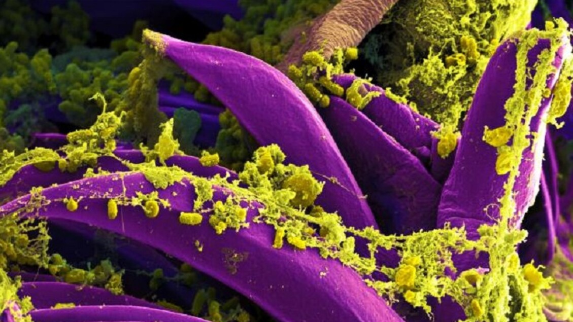 Un gene responsabile della lunga durata della peste nel corso dei secoli