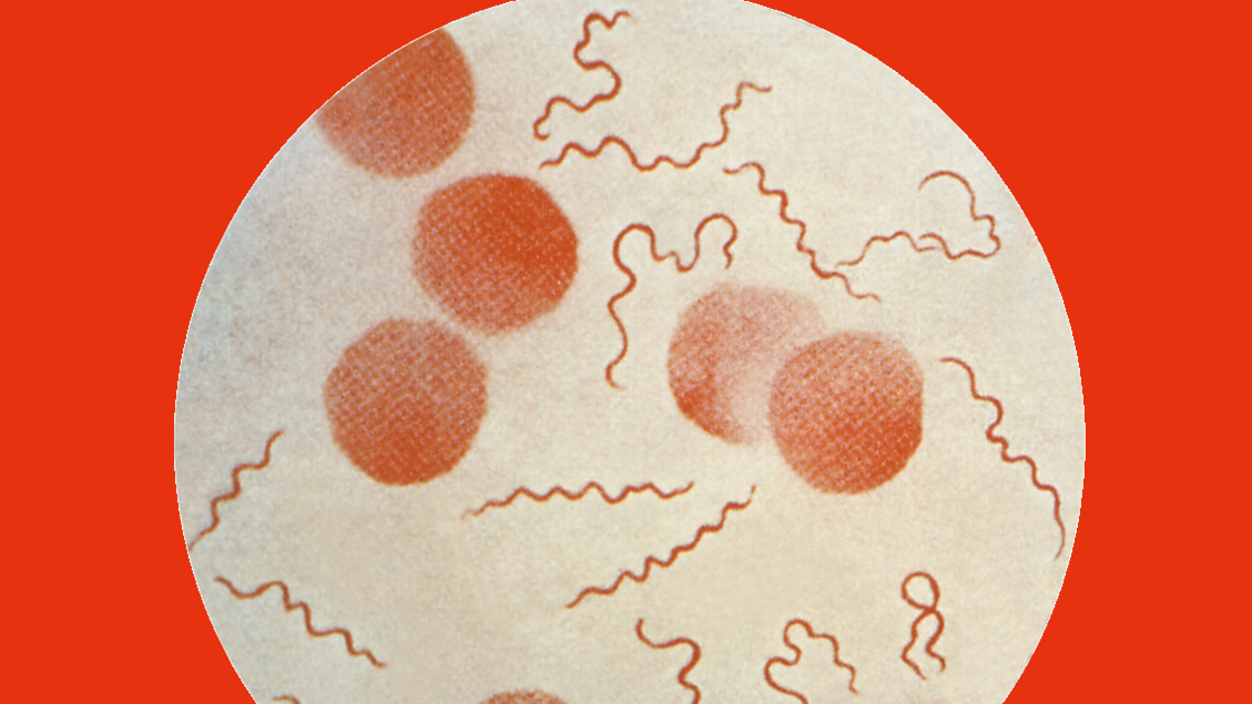 Il Dna antico svela l’evoluzione dei batteri responsabili della febbre