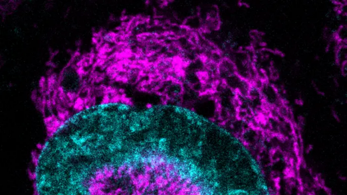 Le cellule tumorali reagiscono a pressione meccanica come strategia difensiva