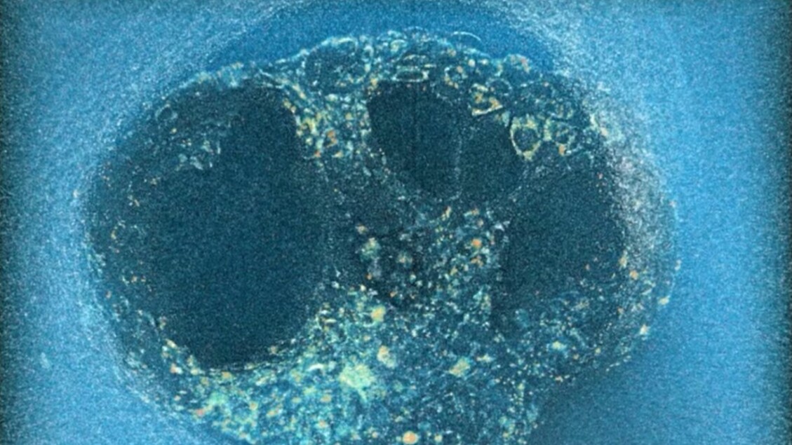 Ripresa inedita dell’impianto di un embrione umano: il video esclusivo