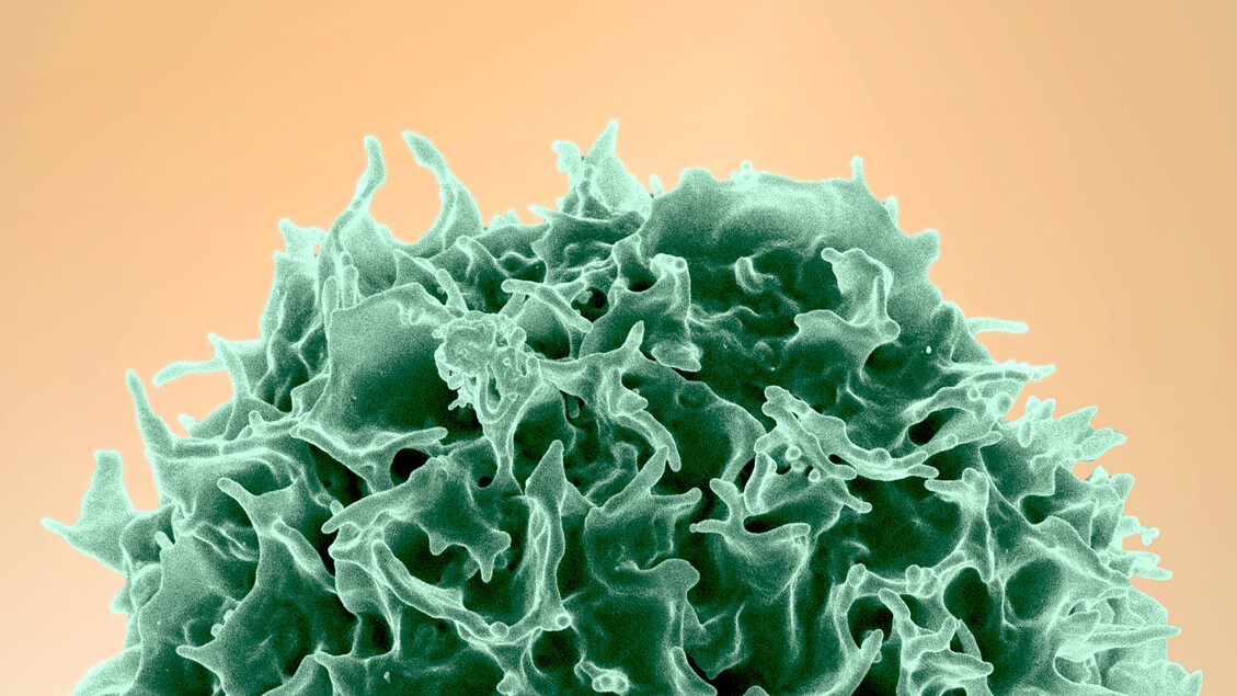 Sclerosi multipla: un canale ostruito offre spunti per terapie innovative