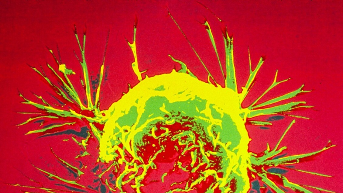 Vaccino anticancro innovativo: efficace contro diverse tipologie di tumore