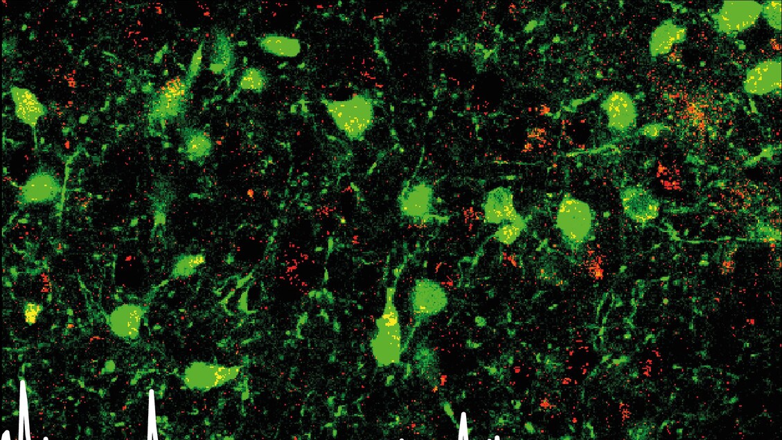 Scoperto nel cervello il circuito responsabile della riduzione dell’ansia