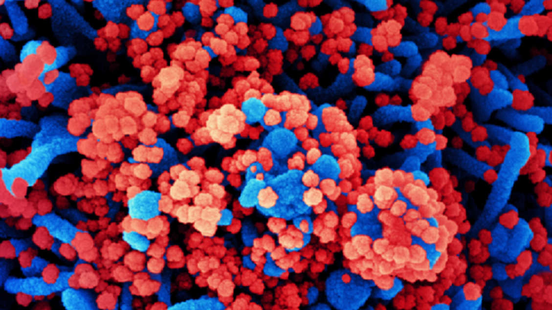 Il Covid modifica la qualità degli spermatozoi e incide sull’ansia nei figli