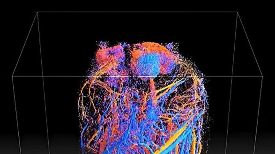 L’ecografia 4D rivela il flusso sanguigno all’interno degli organi interni